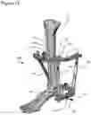 Fig. 16 - External fixation for the correction of bone deformity and trauma