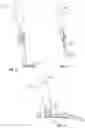 Fig. 10 - Percutaneous vertebral stabilization system
