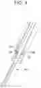 Fig. 05 - Percutaneous access devices and bone anchor assemblies