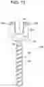 Fig. 16 - Percutaneous access devices and bone anchor assemblies