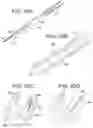 Fig. 24 - Percutaneous access devices and bone anchor assemblies