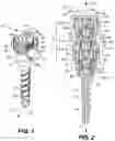 Fig. 02 - Extension-ready spinal support system with vascular-safe pedicle screw