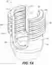 Fig. 03 - Extension-ready spinal support system with vascular-safe pedicle screw