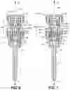 Fig. 05 - Extension-ready spinal support system with vascular-safe pedicle screw