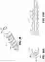 Fig. 11 - Extension-ready spinal support system with vascular-safe pedicle screw