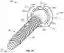 Fig. 05 - Bone anchor