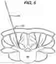 Fig. 09 - Methods and devices for minimally invasive spinal fixation element placement