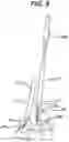 Fig. 11 - Methods and devices for minimally invasive spinal fixation element placement