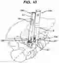 Fig. 13 - Methods and devices for minimally invasive spinal fixation element placement