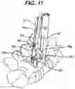 Fig. 14 - Methods and devices for minimally invasive spinal fixation element placement