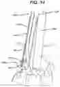 Fig. 17 - Methods and devices for minimally invasive spinal fixation element placement
