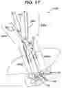 Fig. 20 - Methods and devices for minimally invasive spinal fixation element placement
