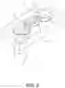 Fig. 15 - Anterior cervical plate assembly