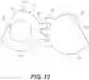 Fig. 20 - Anterior cervical plate assembly