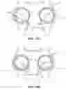Fig. 28 - Anterior cervical plate assembly