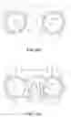 Fig. 31 - Anterior cervical plate assembly