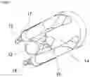 Fig. 04 - Longitudinal Bone Implant