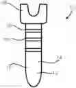 Fig. 01 - BONE FIXATION SCREW WITH DEPLOYABLE ANCHORS