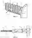 Fig. 11 - BONE FIXATION SCREW WITH DEPLOYABLE ANCHORS