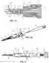 Fig. 14 - BONE FIXATION SCREW WITH DEPLOYABLE ANCHORS