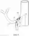 Fig. 04 - COMBINATION DENERVATION THERAPY FOR GLUCOSE CONTROL IN METABOLIC DISORDERS