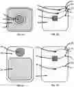 Fig. 02 - SYSTEMS AND METHODS FOR CARDIAC MAPPING AND VECTOR ABLATION WITH A MULTIFUNCTION PATCH ARRAY