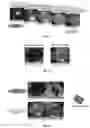 Fig. 06 - Tissue joiner