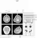 Fig. 08 - SURGICAL SUPPORT DEVICE AND SURGICAL NAVIGATION SYSTEM