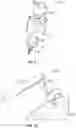 Fig. 09 - Fiducial marker with feedback for robotic surgery