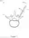 Fig. 08 - Systems and methods for spinal surgical procedures