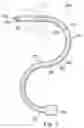 Fig. 03 - Guide apparatus for delivery of a flexible instrument and methods of use