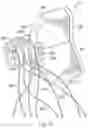 Fig. 08 - Guide apparatus for delivery of a flexible instrument and methods of use