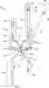 Fig. 01 - SINGLE PORT LAPAROSCOPIC ACCESS SYSTEM WITH EXTERNAL TOOL SUPPORT