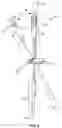 Fig. 03 - SINGLE PORT LAPAROSCOPIC ACCESS SYSTEM WITH EXTERNAL TOOL SUPPORT