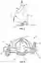 Fig. 05 - SINGLE PORT LAPAROSCOPIC ACCESS SYSTEM WITH EXTERNAL TOOL SUPPORT