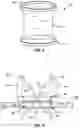 Fig. 07 - SINGLE PORT LAPAROSCOPIC ACCESS SYSTEM WITH EXTERNAL TOOL SUPPORT
