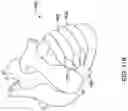 Fig. 13 - MULTI-BALLOON POUCH FORMING DEVICE