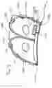 Fig. 04 - Device for providing a sterile limited space for surgery