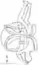 Fig. 18 - Device for providing a sterile limited space for surgery