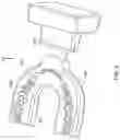 Fig. 05 - Patient-specific tray for orthodontic vibrational force management
