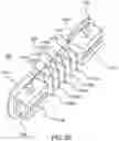 Fig. 10 - Extended buccal tube