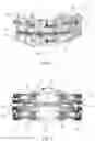 Fig. 02 - Intra-oral device