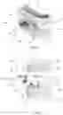 Fig. 07 - Intra-oral device