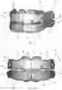 Fig. 08 - Intra-oral device