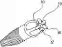 Fig. 01 - Dental insert