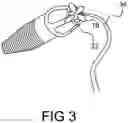 Fig. 04 - Dental insert