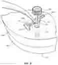 Fig. 15 - Method for forming bis-acrylic or other crown