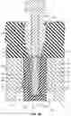 Fig. 16 - Method for forming bis-acrylic or other crown