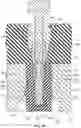 Fig. 18 - Method for forming bis-acrylic or other crown