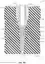 Fig. 19 - Method for forming bis-acrylic or other crown